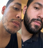 Bálsamo para Crecimiento de Barba Ultra Potente con Minoxidil 20% | 100mL