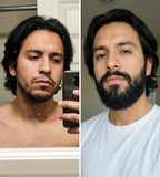 Bálsamo para Crecimiento de Barba Ultra Potente con Minoxidil 20% | 100mL